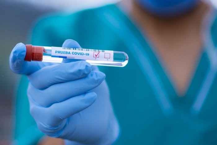 Ilustračný obrázok k článku Najvyšší nárast pozitívne testovaných na koronavírus je v okrese Košice